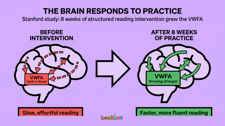 Chart showing brain changes before and after reading intervention